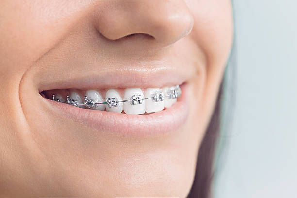 Best Teeth Whitening  in Kingston, IL